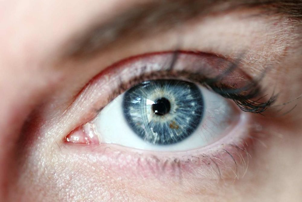 Quattro interventi microchirurgia cornea in 3d all'ospedale dell'aquila