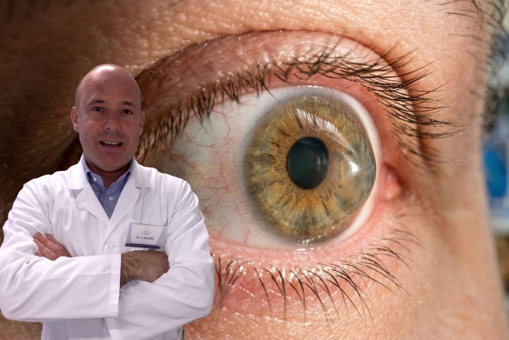 Cambio occhiali continuo Attenzione al Cheratocono