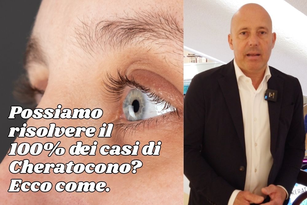 Diagnosi Precoce Cheratocono 2026