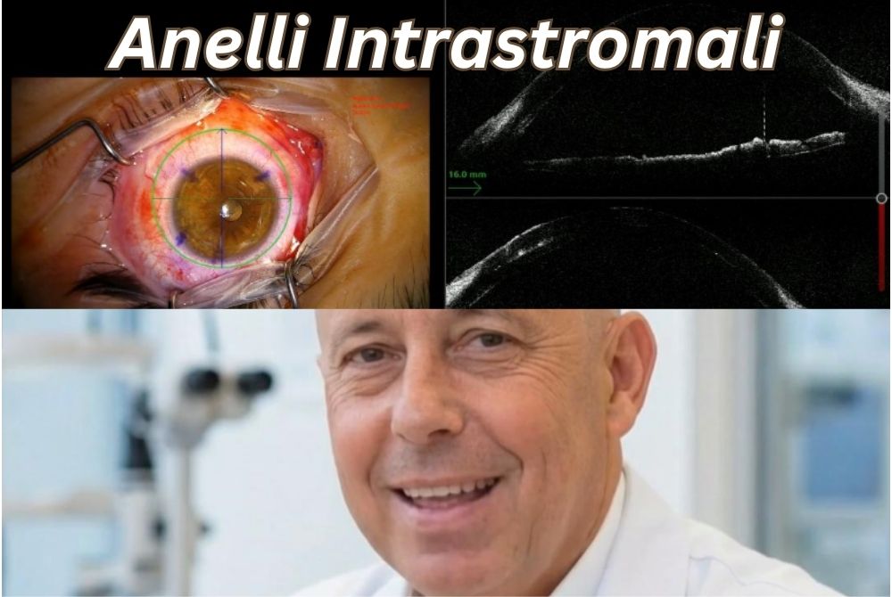 geometria che rimodella la vista